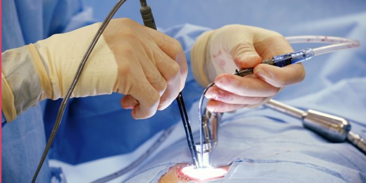 Endoskopska operacija kičme u Atlas Bolnici